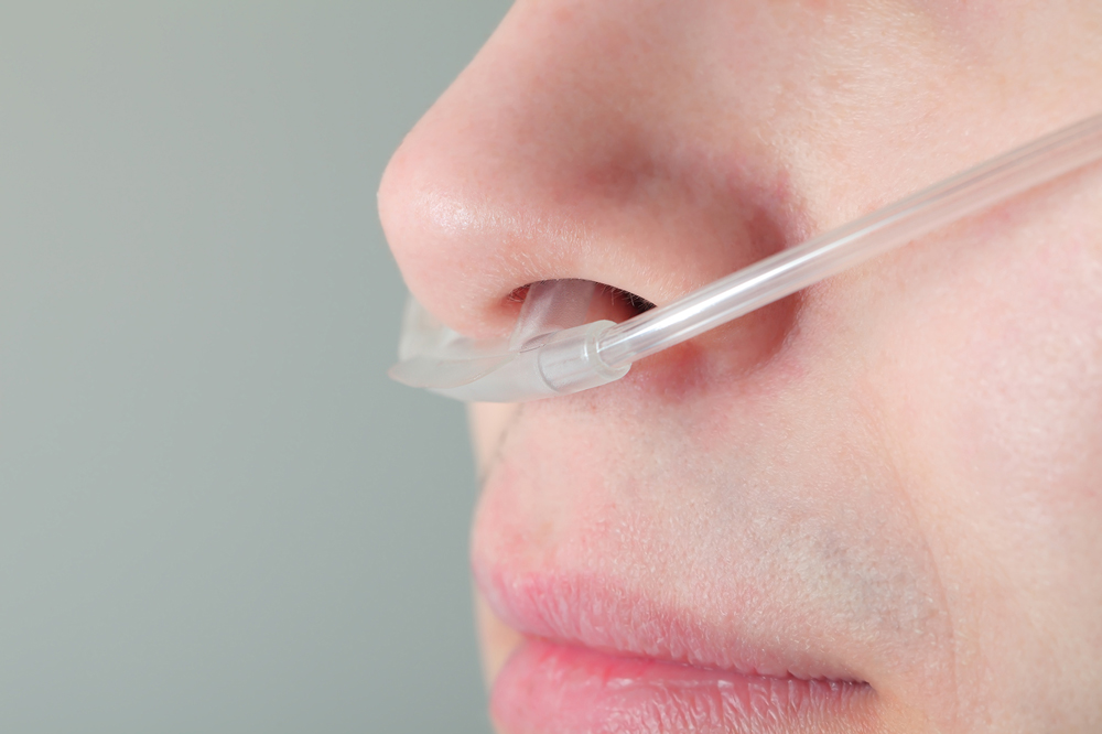 Ein Patient erhält komfortabel Sauerstoff-Therapie über eine Nasenbrille im Bett, was die einfache Anwendung und Unterstützung durch Pielmeier Medizintechnik veranschaulicht.